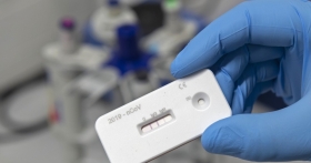 Laboratorios denuncian aumento de pruebas r&aacute;pidas 'ilegales' de #COVID19