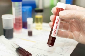 Preparaci&oacute;n y respuesta a la enfermedad por Coronavirus 2019 (COVID-19) 